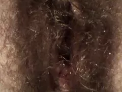 همسر من با سر و دست شکسن مودار.